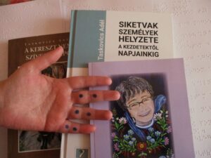 The Picture shows the author's hand on top of her three books, palm up. Near the palm, two joints of her middle finger, ring finger and the little finger have the six dots stamped on them. By touching the fingers of a deafblind person with the tips of our fingers at the places indicated by the drawing, we can write in Braille on their hands. This is how we can communicate our message.